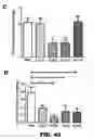 Fig. 83 - Antibodies to tau