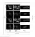 Fig. 35 - USE OF COX-3 BINDING MOLECULES FOR MODULATING AUTOPHAGY