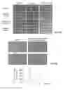 Fig. 07 - Antisense Oligonucleotides Against Neutral Sphingomyelinase and Neutral Sphingomyelinase Inhibitor GW4869 for Degenerative Neurological Disorders