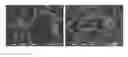 Fig. 02 - METHODS FOR REMOVING HEMICELLULOSE