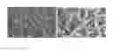 Fig. 03 - METHODS FOR REMOVING HEMICELLULOSE