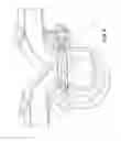 Fig. 05 - Diverter valve for charge air system