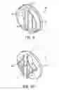 Fig. 06 - Valve assembly having improved rotational feel