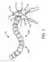 Fig. 02 - ARTICULATING RESTRAINT DEVICE