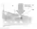 Fig. 01 - METHODS AND DEVICES FOR TESTING THE STABILITY OF INTRALUMINAL IMPLANTS