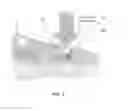 Fig. 02 - METHODS AND DEVICES FOR TESTING THE STABILITY OF INTRALUMINAL IMPLANTS