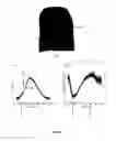 Fig. 04 - Device and a method for characterising a chromatic property of foodstuff
