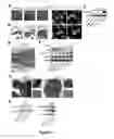 Fig. 08 - Simultaneous detection of cannibalism and senescence as prognostic marker for cancer