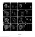 Fig. 02 - CIRCULATING TUMOR CELL DIAGNOSTICS FOR LUNG CANCER