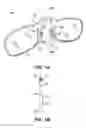 Fig. 02 - Universal eyewear