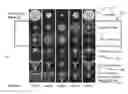 Fig. 01 - Lenses, devices, methods and systems for refractive error