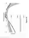Fig. 65 - Lenses, devices, methods and systems for refractive error