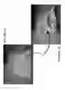 Fig. 02 - Devices, systems, and methods for using corrugated tessellation to create surface features