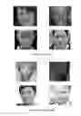 Fig. 08 - Image processing apparatus and method for fitting a deformable shape model to an image using random forest regression voting