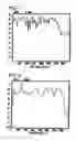 Fig. 05 - Voice activity detection/silence suppression system