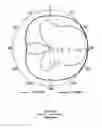 Fig. 10 - Antenna configuration for use in a mobile communication device