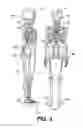 Fig. 03 - Smartphone-controlled active configuration of footwear, including with one or more of chambers, compartments, bladders and internal sipes
