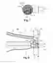 Fig. 06 - Earmold for active occlusion cancellation