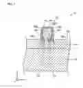 Fig. 04 - Wiring substrate and production method therefor