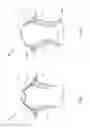 Fig. 04 - Compression garments and a method of manufacture