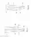 Fig. 07 - Compression garments and a method of manufacture