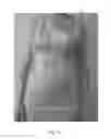 Fig. 02 - Breastfeeding attire