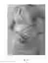 Fig. 05 - Breastfeeding attire
