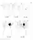 Fig. 07 - Breastfeeding attire