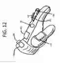 Fig. 13 - Partial Fingered Glove