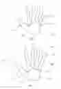 Fig. 05 - Glove with Free-floating Double Layer of Protective Mesh
