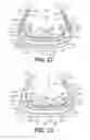 Fig. 18 - Microprocessor control of bladders in footwear soles with internal flexibility sipes