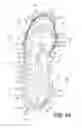 Fig. 31 - Microprocessor control of bladders in footwear soles with internal flexibility sipes