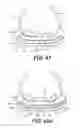 Fig. 37 - Microprocessor control of bladders in footwear soles with internal flexibility sipes