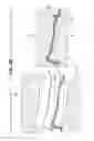 Fig. 19 - SHOE