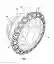 Fig. 02 - Gem Setting in Basket