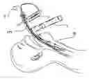Fig. 01 - Intubation accessory