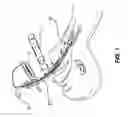 Fig. 02 - Intubation accessory