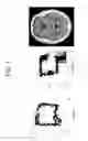 Fig. 08 - Methods and kits for assessing central nervous system integrity