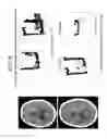 Fig. 09 - Methods and kits for assessing central nervous system integrity