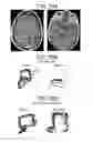 Fig. 35 - Methods and kits for assessing central nervous system integrity