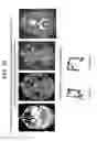 Fig. 43 - Methods and kits for assessing central nervous system integrity