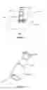 Fig. 02 - Introducer assembly and methods of use