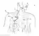 Fig. 01 - METHOD OF TREATING SLEEP DISORDERED BREATHING
