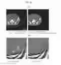 Fig. 14 - X-ray CT apparatus and X-ray CT image processing method