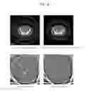 Fig. 18 - X-ray CT apparatus and X-ray CT image processing method