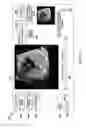 Fig. 07 - APPARATUS AND METHOD FOR FETAL INTELLIGENT NAVIGATION ECHOCARDIOGRAPHY