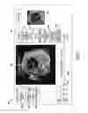 Fig. 08 - APPARATUS AND METHOD FOR FETAL INTELLIGENT NAVIGATION ECHOCARDIOGRAPHY