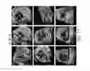 Fig. 16 - APPARATUS AND METHOD FOR FETAL INTELLIGENT NAVIGATION ECHOCARDIOGRAPHY