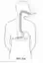 Fig. 04 - TRANSLUMINAL ENDOSCOPIC SURGERY KIT