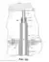 Fig. 09 - TRANSLUMINAL ENDOSCOPIC SURGERY KIT